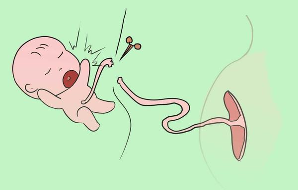 超聲黄瓜网站APP观看大全之新生兒臍帶護理你做對了嗎 超聲黄瓜网站APP观看大全之新生兒臍帶護理你做對了嗎